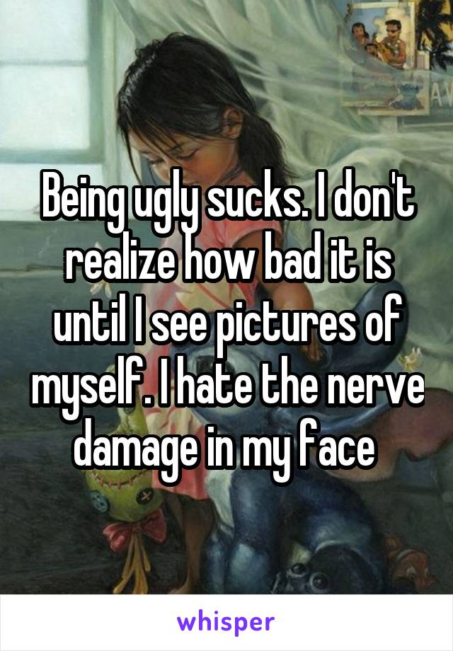 Being ugly sucks. I don't realize how bad it is until I see pictures of myself. I hate the nerve damage in my face 