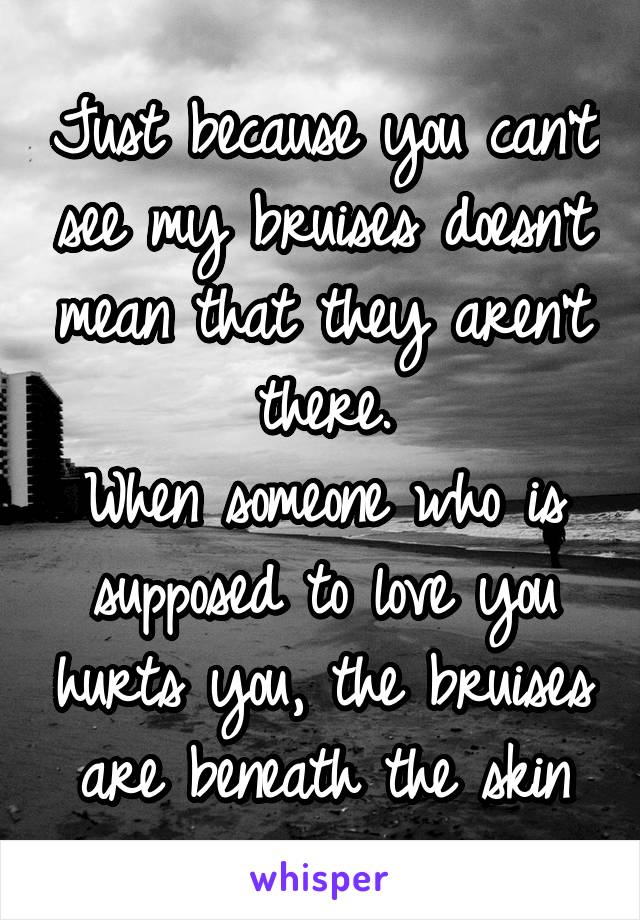 Just because you can't see my bruises doesn't mean that they aren't there.
When someone who is supposed to love you hurts you, the bruises are beneath the skin