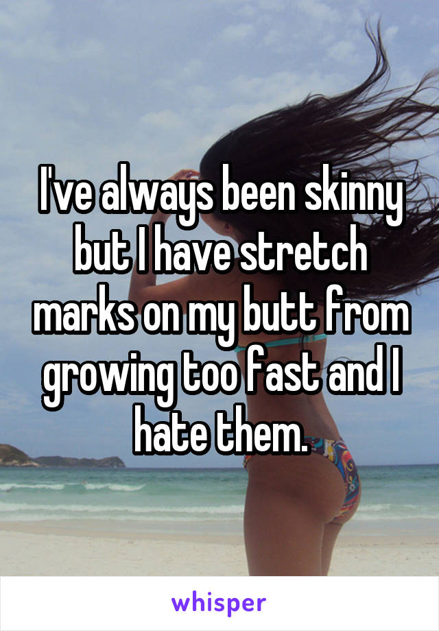 I've always been skinny but I have stretch marks on my butt from growing too fast and I hate them.