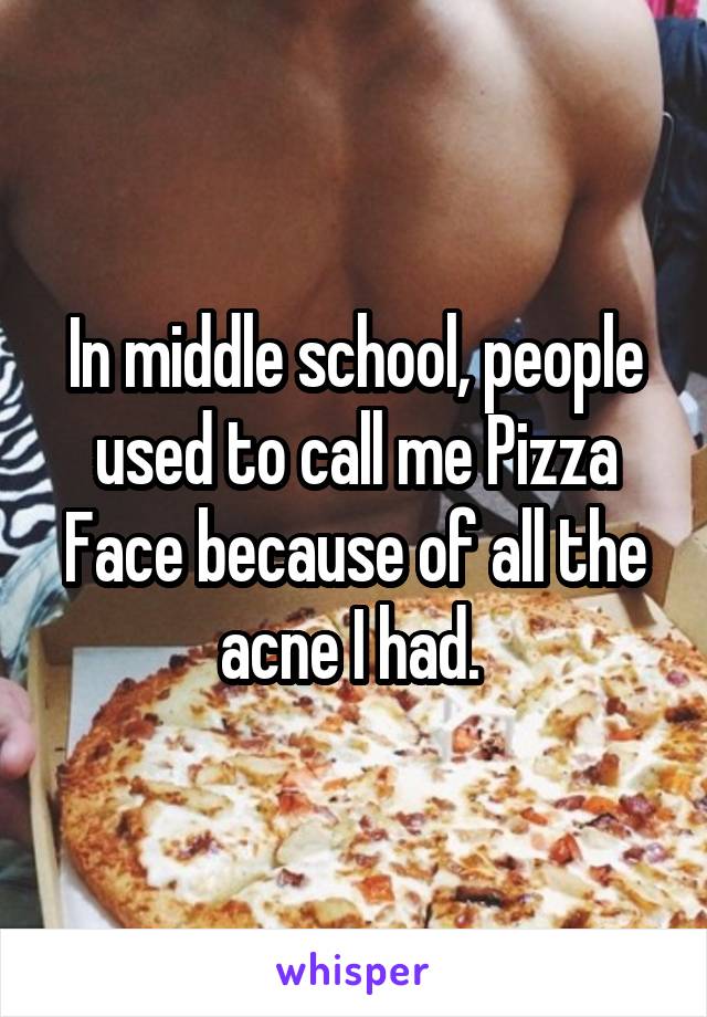 In middle school, people used to call me Pizza Face because of all the acne I had. 