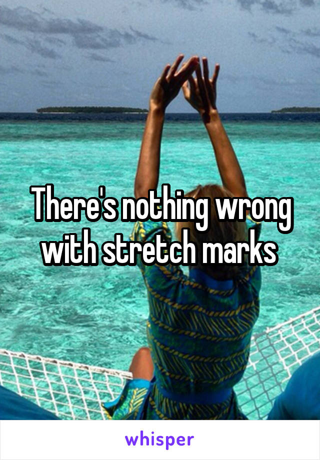 There's nothing wrong with stretch marks 