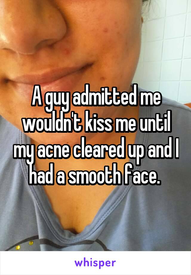 A guy admitted me wouldn't kiss me until my acne cleared up and I had a smooth face. 