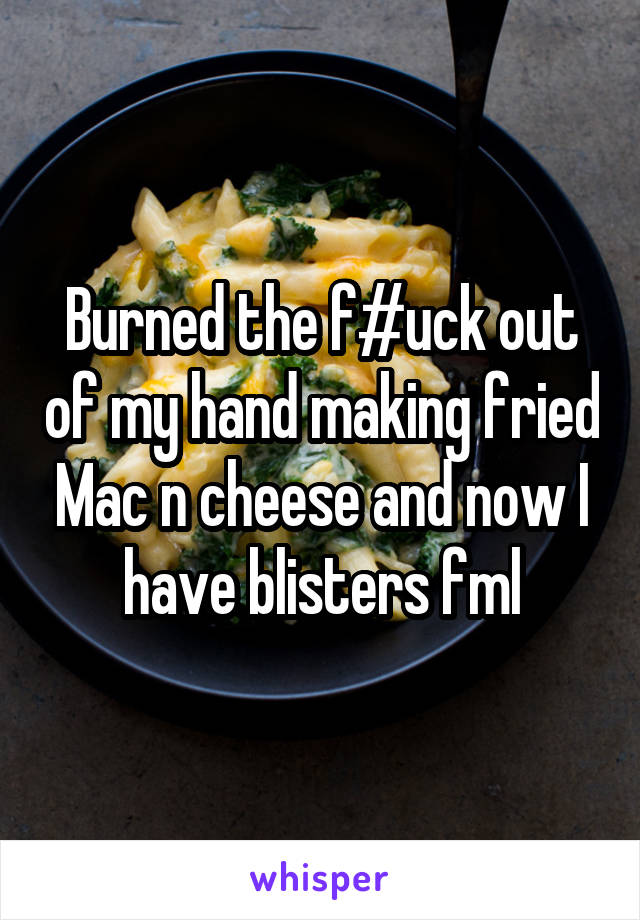 Burned the f#uck out of my hand making fried Mac n cheese and now I have blisters fml