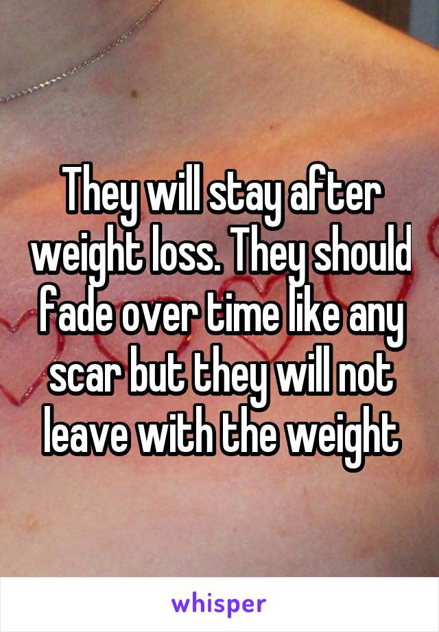 They will stay after weight loss. They should fade over time like any scar but they will not leave with the weight