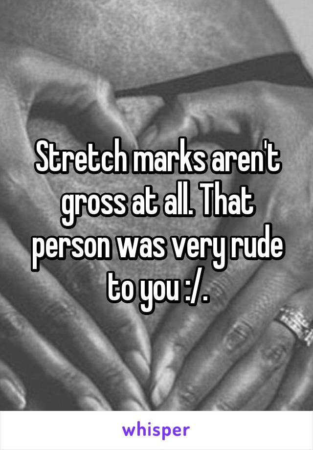 Stretch marks aren't gross at all. That person was very rude to you :/.