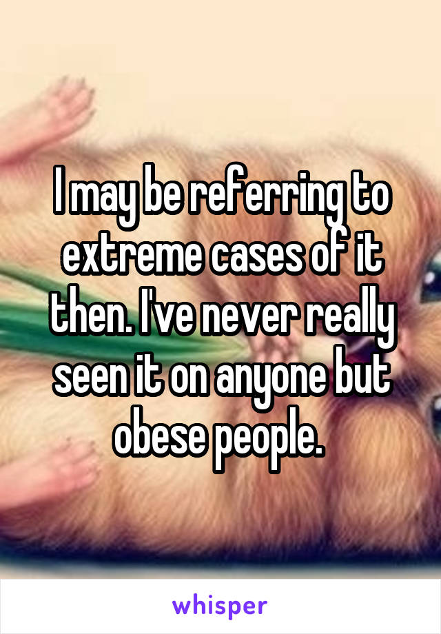 I may be referring to extreme cases of it then. I've never really seen it on anyone but obese people. 