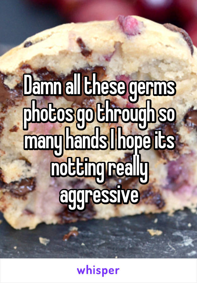 Damn all these germs photos go through so many hands I hope its notting really aggressive
