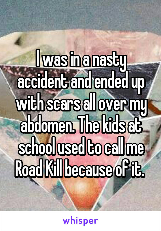 I was in a nasty accident and ended up with scars all over my abdomen. The kids at school used to call me Road Kill because of it. 