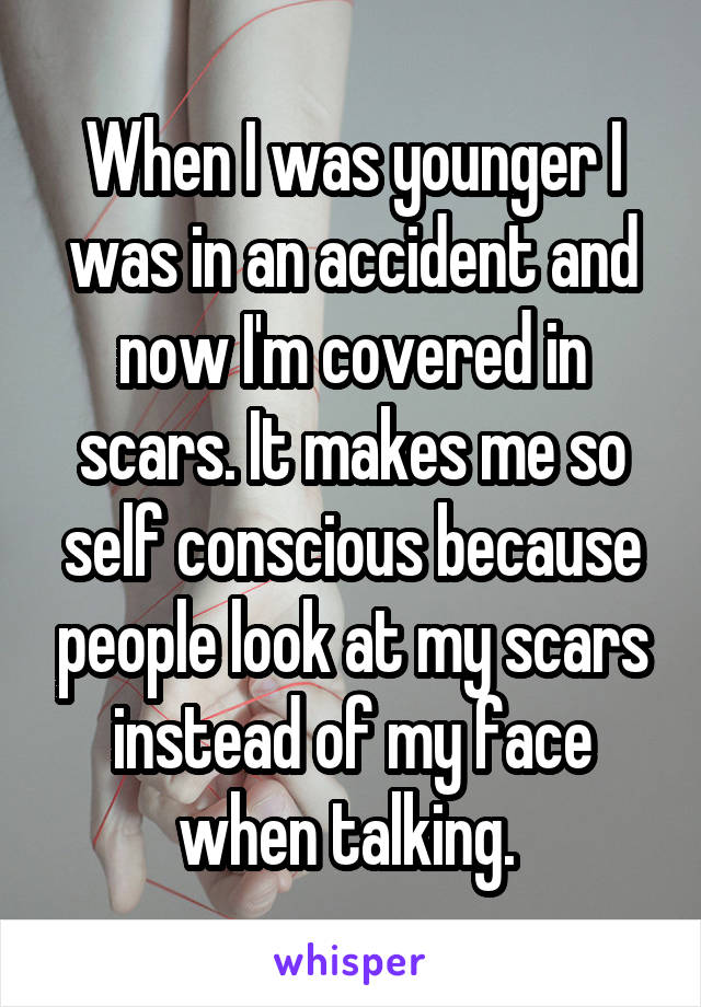 When I was younger I was in an accident and now I'm covered in scars. It makes me so self conscious because people look at my scars instead of my face when talking. 
