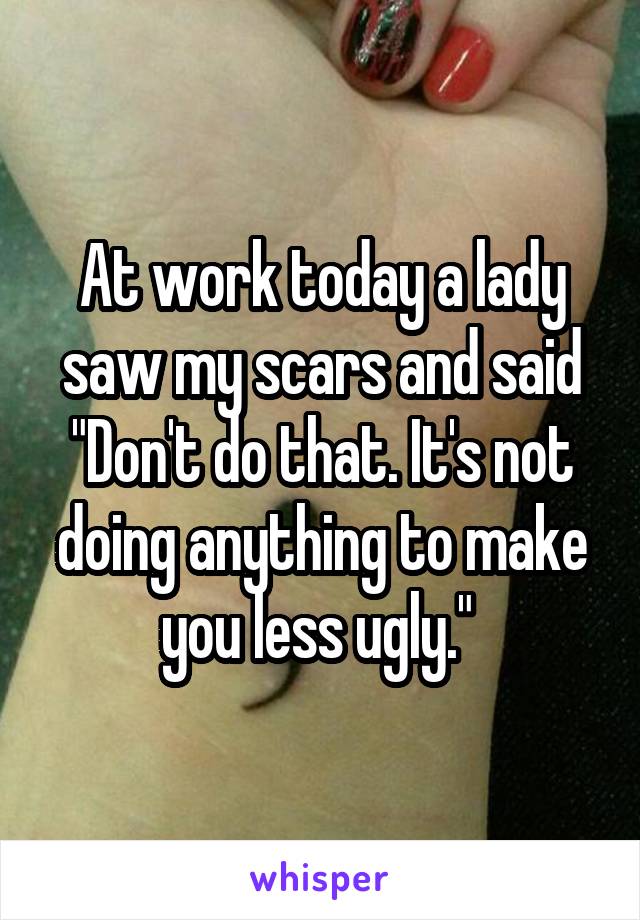 At work today a lady saw my scars and said "Don't do that. It's not doing anything to make you less ugly." 