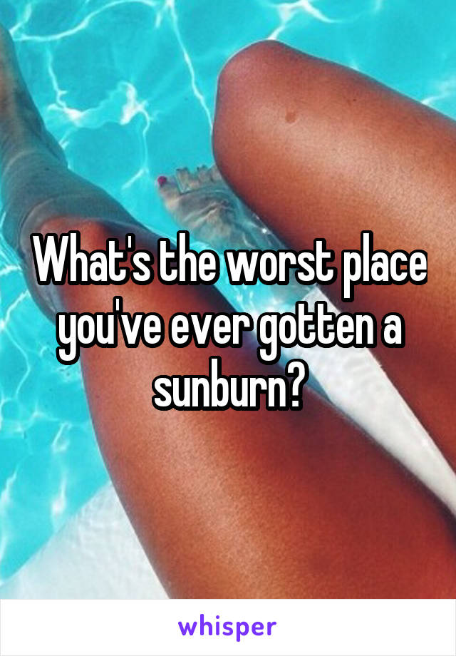 What's the worst place you've ever gotten a sunburn?