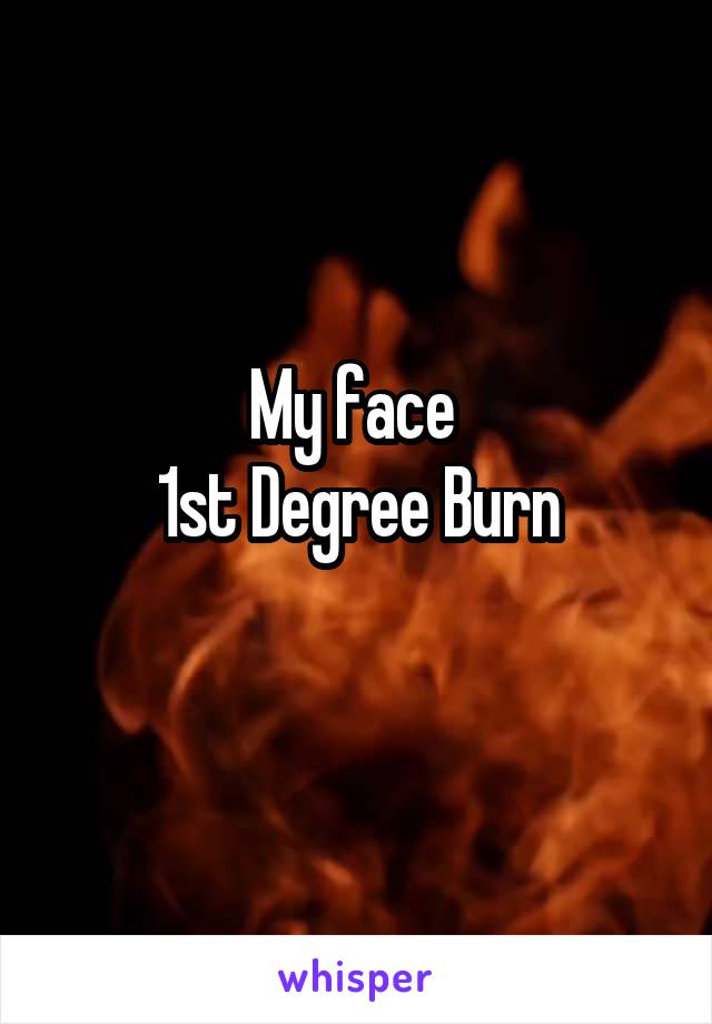 My face 
1st Degree Burn
