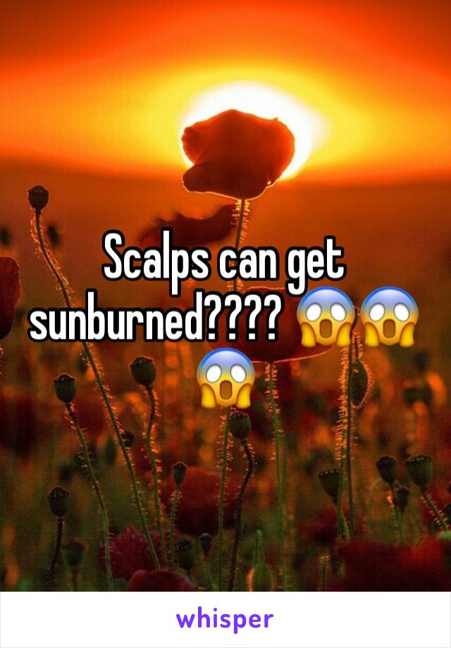 Scalps can get sunburned???? 😱😱😱