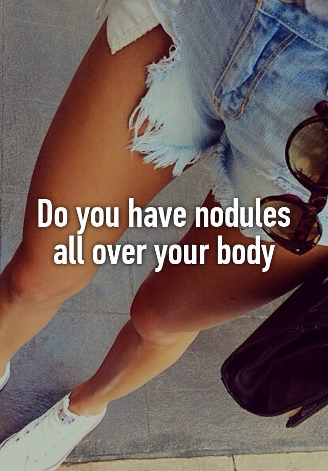 do-you-have-nodules-all-over-your-body