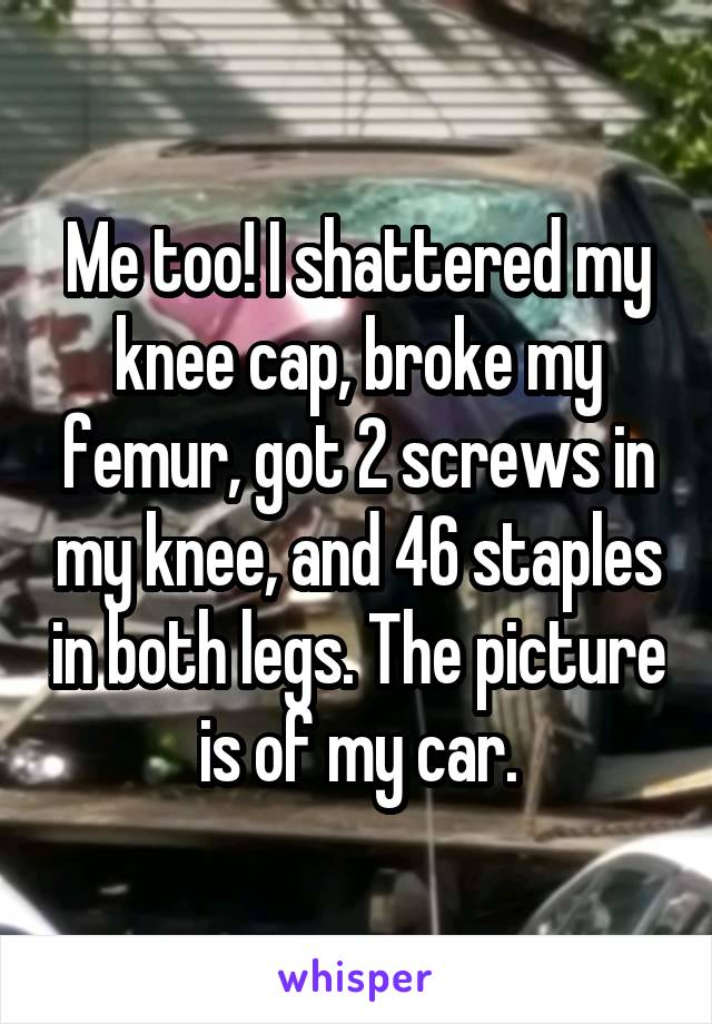 Me too! I shattered my knee cap, broke my femur, got 2 screws in my knee, and 46 staples in both legs. The picture is of my car.