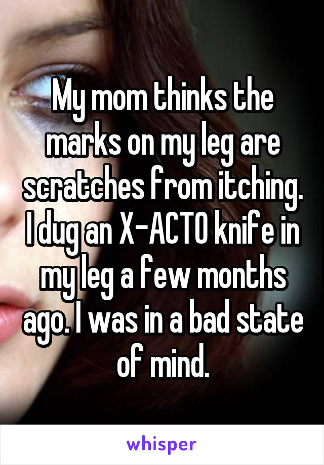 My mom thinks the marks on my leg are scratches from itching. I dug an X-ACTO knife in my leg a few months ago. I was in a bad state of mind.