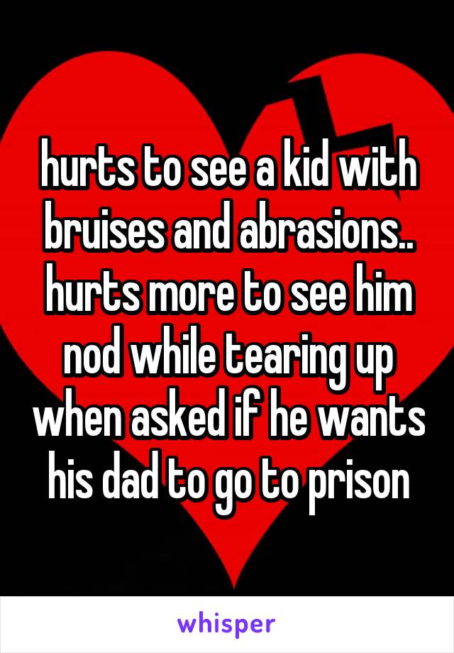 hurts to see a kid with bruises and abrasions.. hurts more to see him nod while tearing up when asked if he wants his dad to go to prison