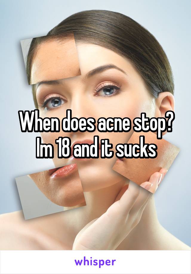 When does acne stop? Im 18 and it sucks