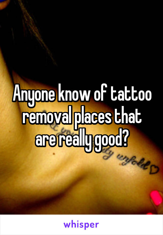 Anyone know of tattoo removal places that are really good?