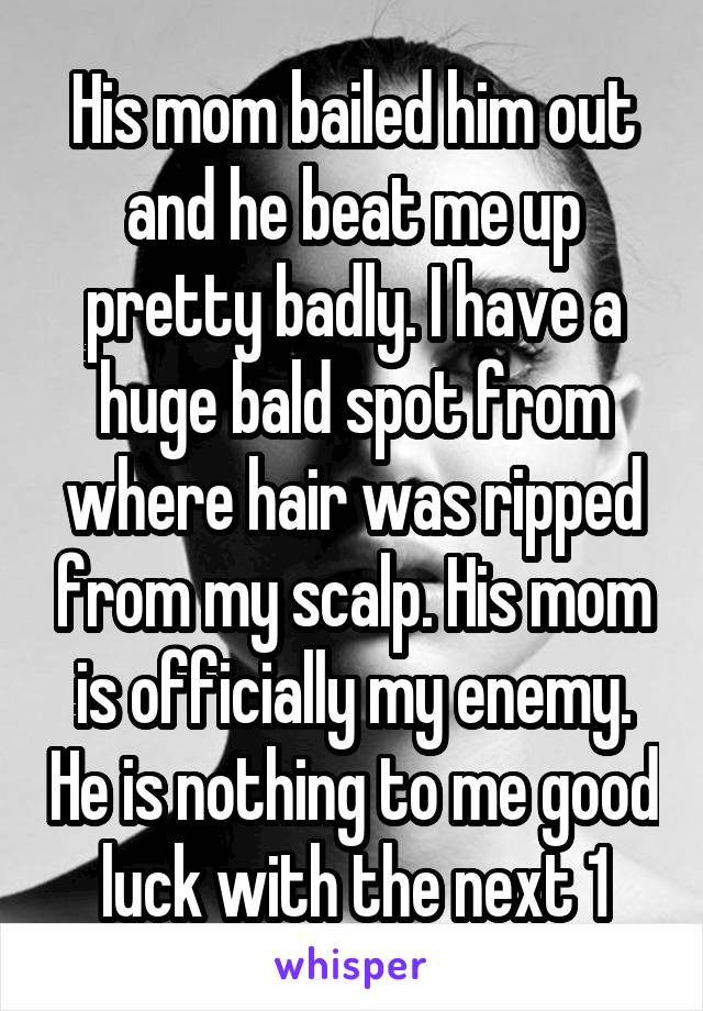 His mom bailed him out and he beat me up pretty badly. I have a huge bald spot from where hair was ripped from my scalp. His mom is officially my enemy. He is nothing to me good luck with the next 1