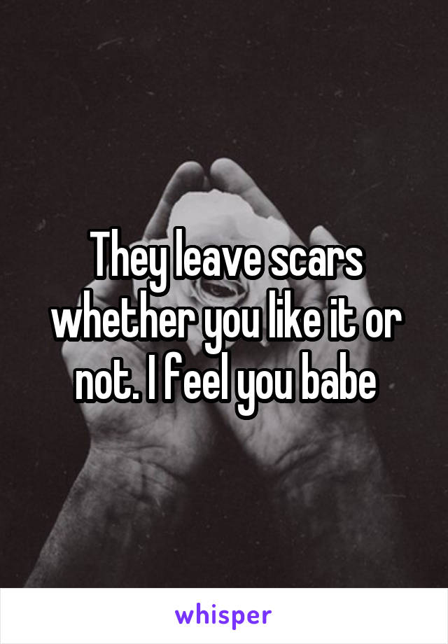 They leave scars whether you like it or not. I feel you babe