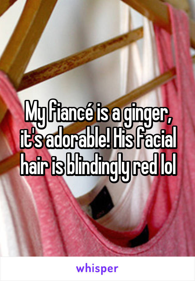 My fiancé is a ginger, it's adorable! His facial hair is blindingly red lol