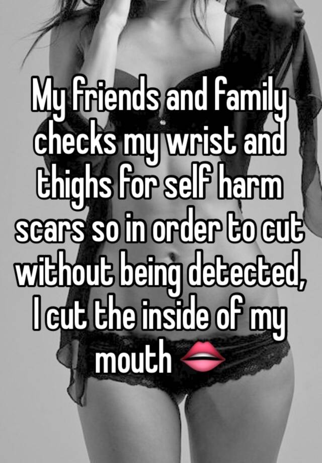 my-friends-and-family-checks-my-wrist-and-thighs-for-self-harm-scars-so