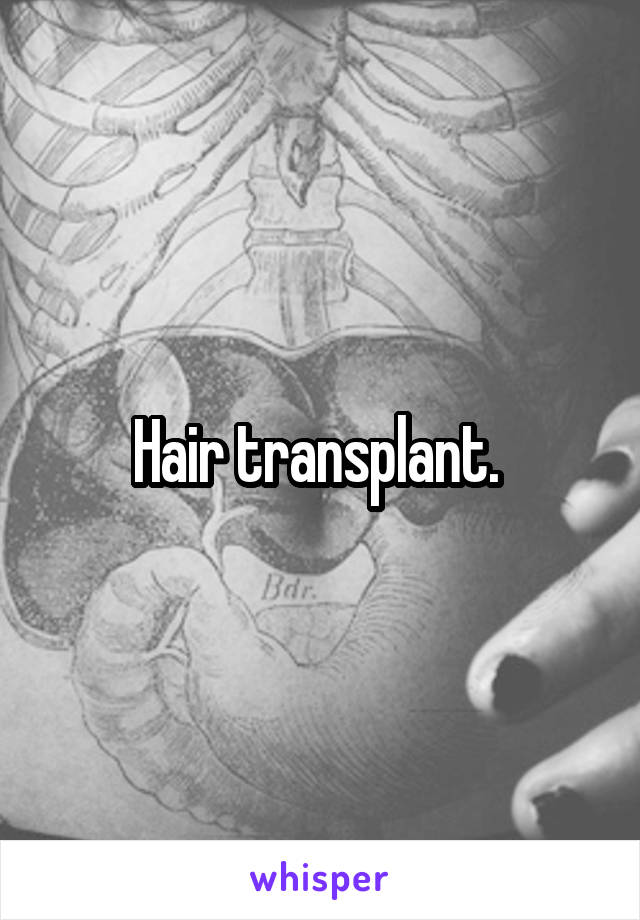 Hair transplant. 