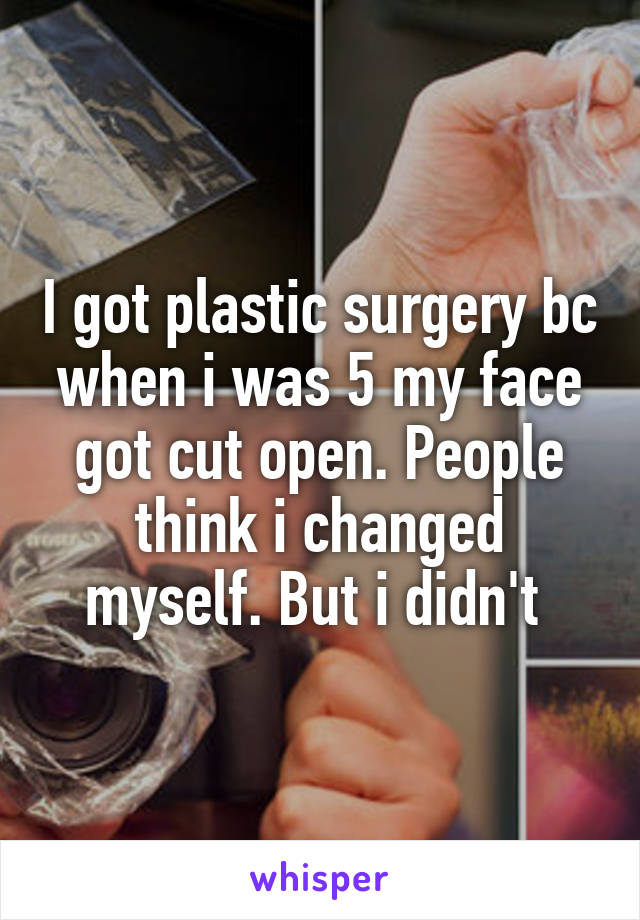 I got plastic surgery bc when i was 5 my face got cut open. People think i changed myself. But i didn't 
