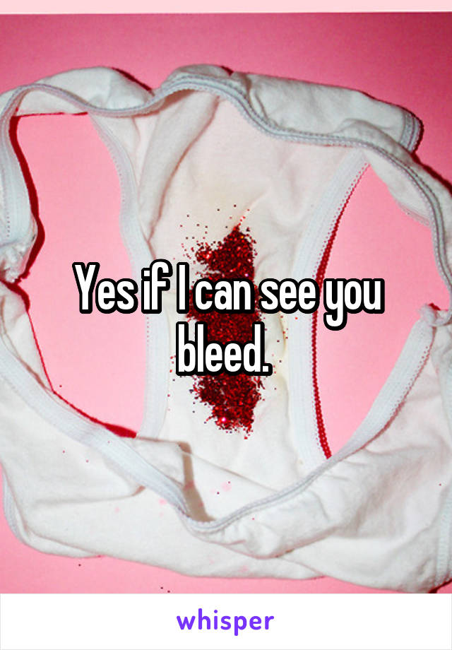Yes if I can see you bleed. 