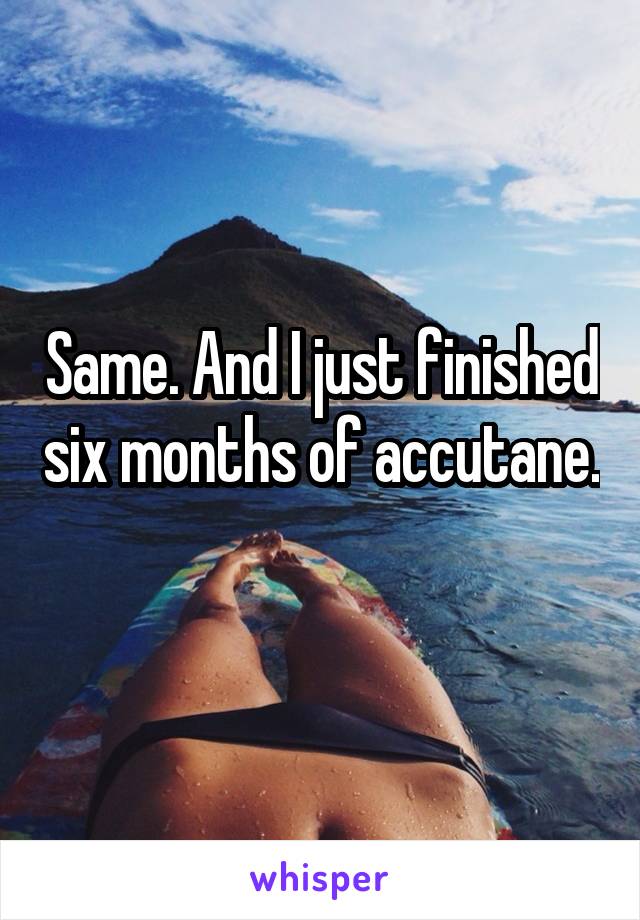 Same. And I just finished six months of accutane. 