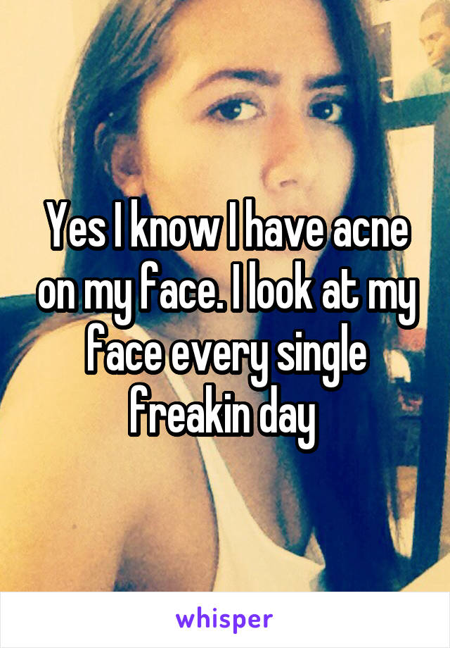 Yes I know I have acne on my face. I look at my face every single freakin day 