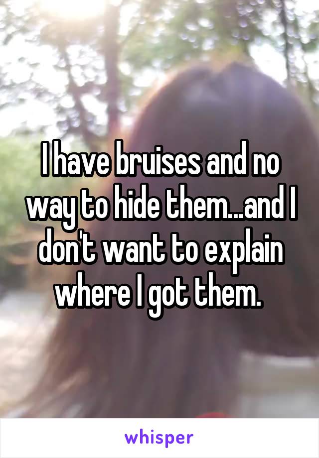 I have bruises and no way to hide them...and I don't want to explain where I got them. 