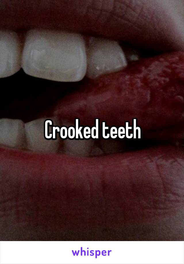 Crooked teeth