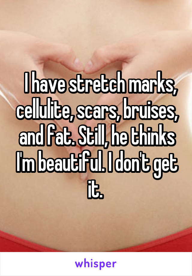   I have stretch marks, cellulite, scars, bruises, and fat. Still, he thinks I'm beautiful. I don't get it. 