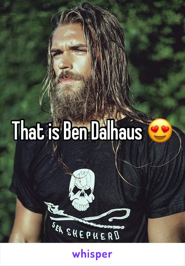 That is Ben Dalhaus 😍