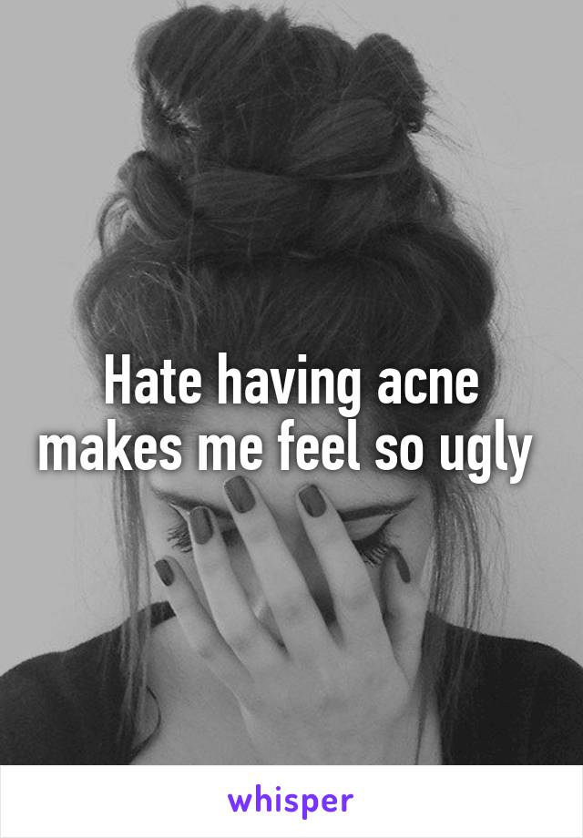 Hate having acne makes me feel so ugly 