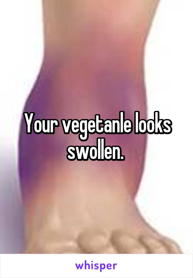 Your vegetanle looks swollen. 