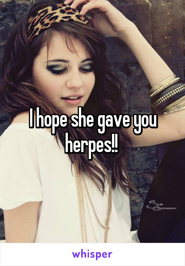 I hope she gave you herpes!! 