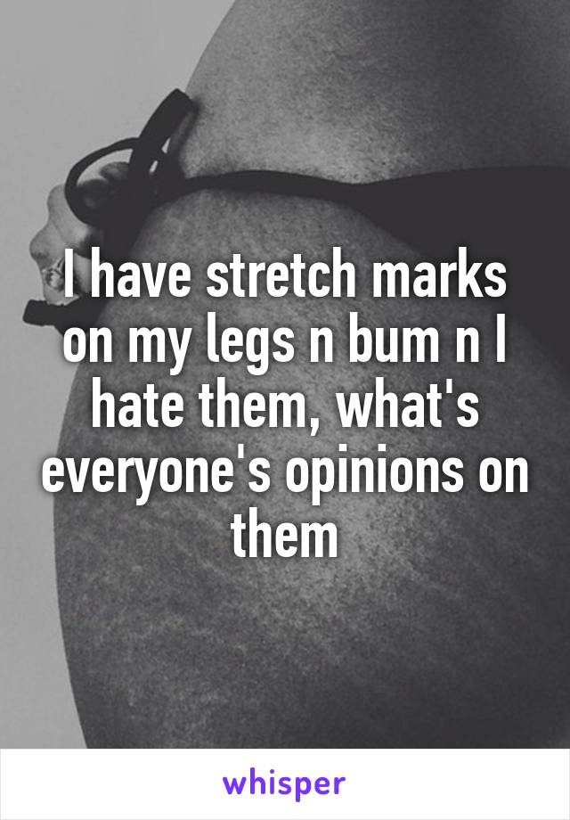 I have stretch marks on my legs n bum n I hate them, what's everyone's opinions on them