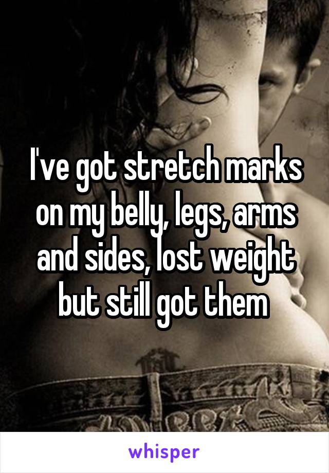 I've got stretch marks on my belly, legs, arms and sides, lost weight but still got them 