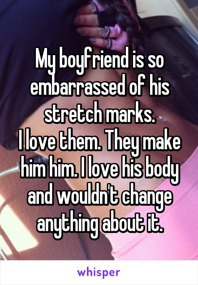 My boyfriend is so embarrassed of his stretch marks.
I love them. They make him him. I love his body and wouldn't change anything about it.