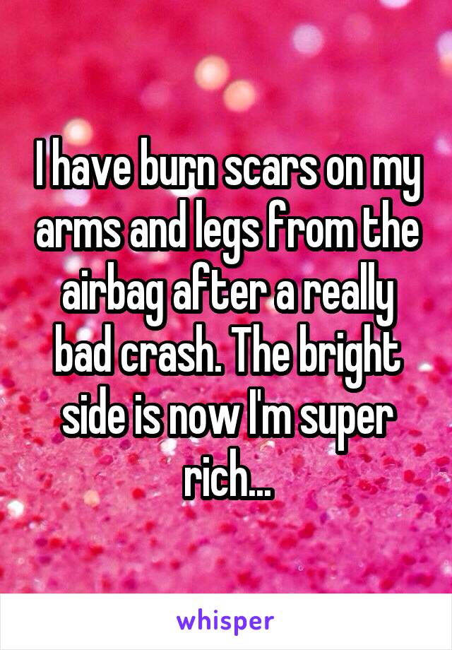 I have burn scars on my arms and legs from the airbag after a really bad crash. The bright side is now I'm super rich...