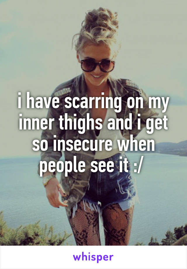 i have scarring on my inner thighs and i get so insecure when people see it :/ 