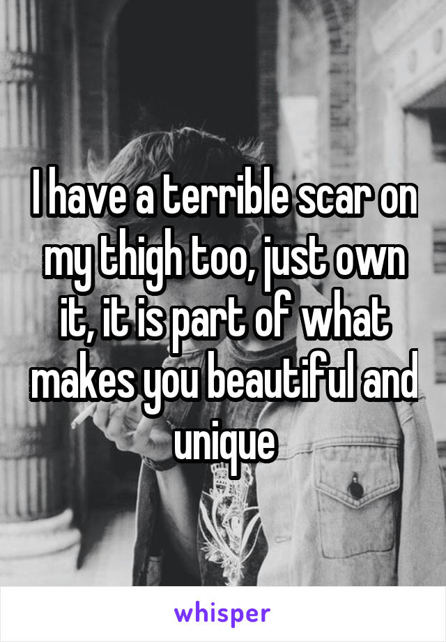 I have a terrible scar on my thigh too, just own it, it is part of what makes you beautiful and unique