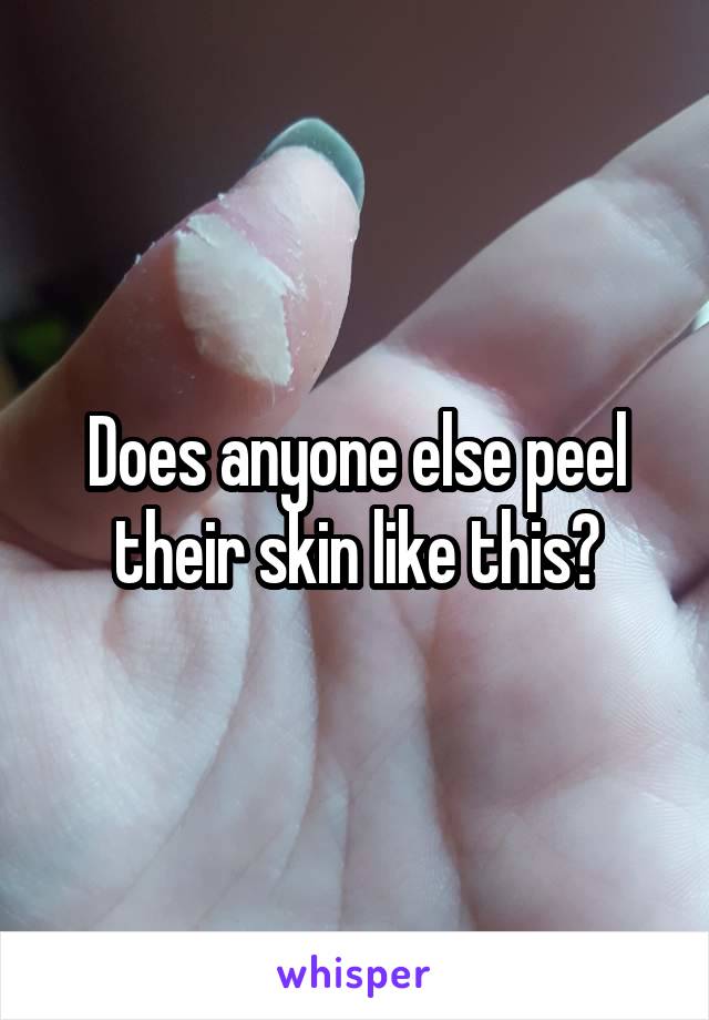 Does anyone else peel their skin like this?