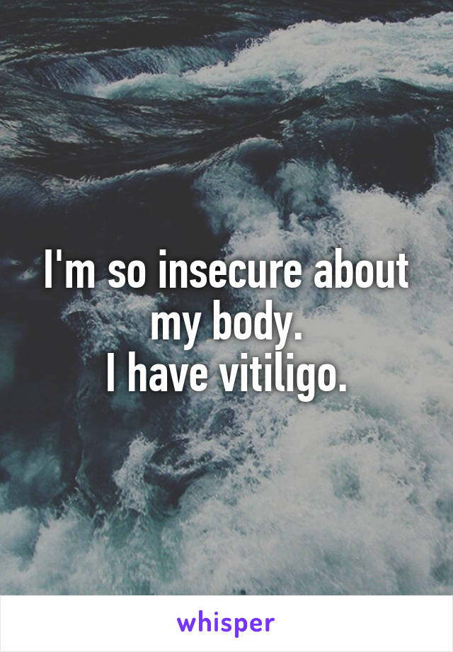 I'm so insecure about my body.
I have vitiligo.