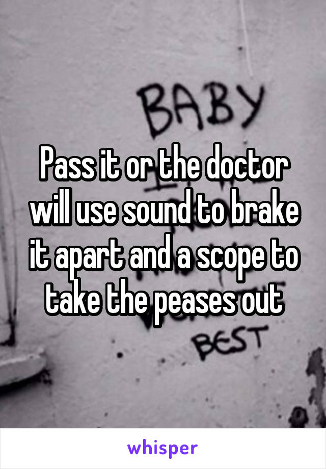 Pass it or the doctor will use sound to brake it apart and a scope to take the peases out