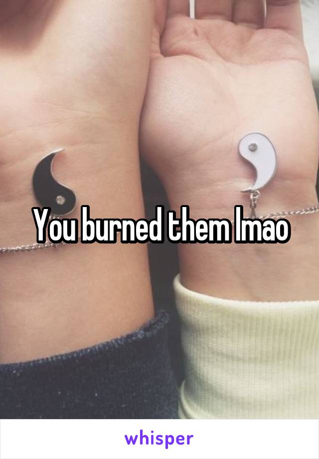 You burned them lmao