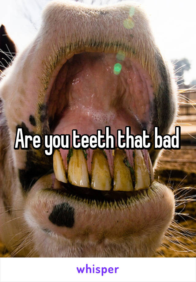 Are you teeth that bad 